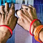 कुष्ठरोग विरुद्धको दिवस: १६ जिल्ला अझै कुष्ठरोग मुक्त हुन बाँकी